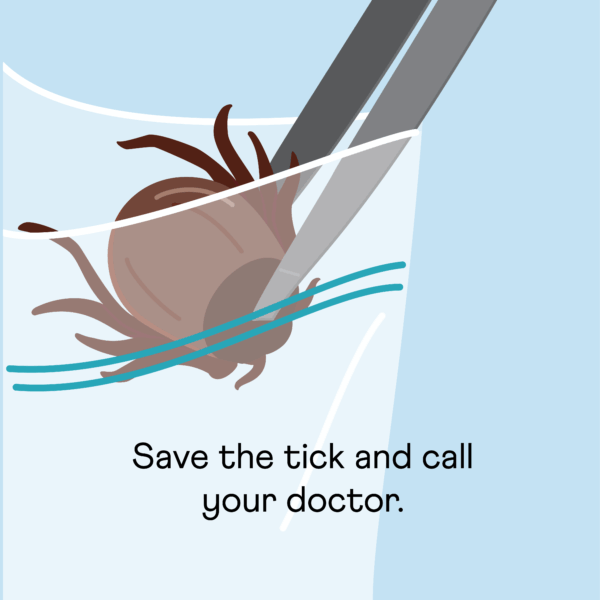Image of tweezers placing a tick into a plastic bad with the text "save the tick and call your doctor"