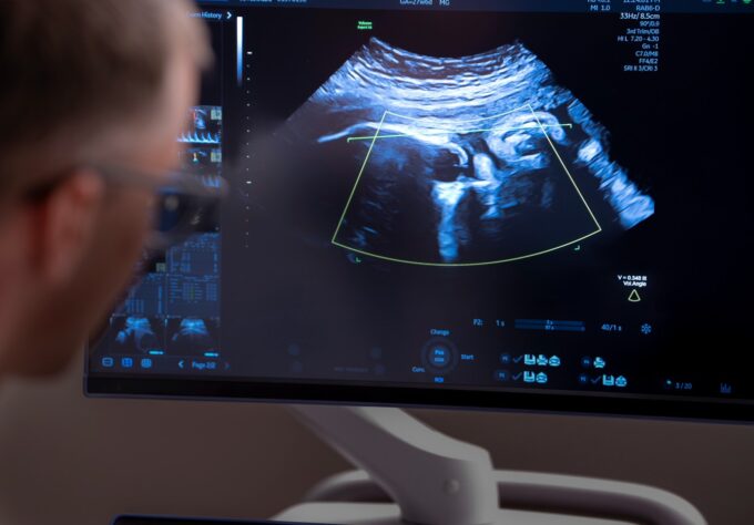 Close-up view of a prenatal ultrasound monitor displaying fetal imaging used to evaluate fetal development and guide treatment planning.