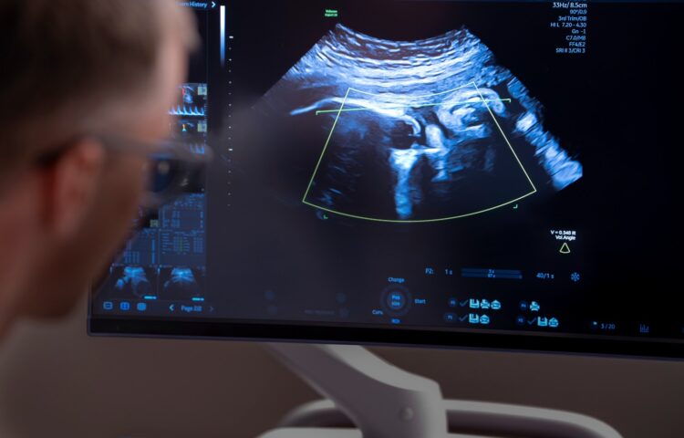 Close-up view of a prenatal ultrasound monitor displaying fetal imaging used to evaluate fetal development and guide treatment planning.