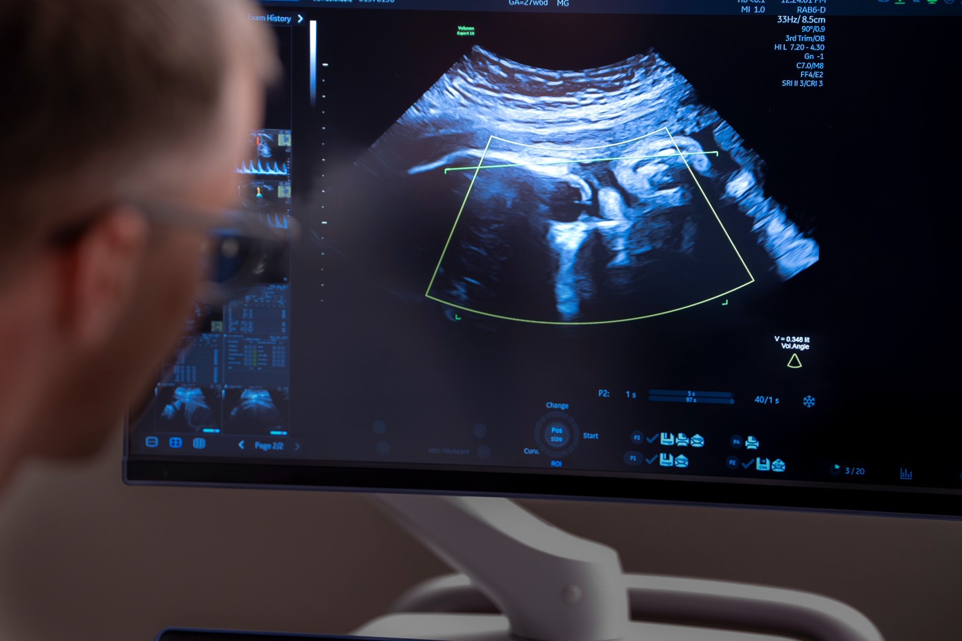 Doctor looking at ultrasound image on a screen as a part of parental genetic screening.